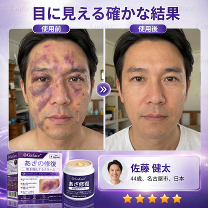 [販売数𝟏𝟏万個以上] 👩‍⚕️☑️𝐆𝐚𝐟𝐚𝐜𝐞®打撲ケア肌強化クリ一ム
