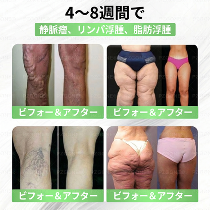 𝑳𝒖𝒙𝒂𝒓𝒊𝒔𝒆® 🌼 モリンガ×ベルベリン 高度ナノマイクロニードルパッチ(毎日使用で、7日目には目に見える変化を実感 ）👩‍⚕️ 肥満、糖尿病、睡眠時無呼吸症候群、関節のトラブル。