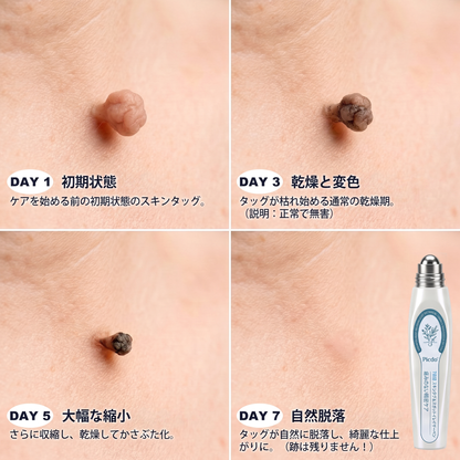 🌼公式ブランドストア  𝐏i𝐜𝐝o® 𝟕日間イボ&シミ消し(痛みも傷跡もゼロのローラーボール)
