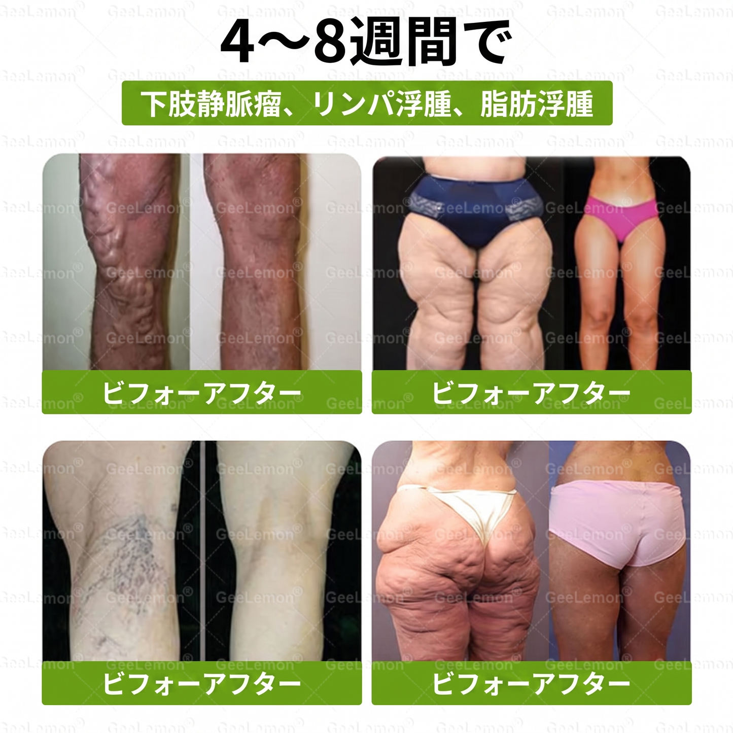 公式認定🌼日本国内で数万人ものユーザーにご満足いただいています。🔥GEELEMON ®  GLUMASETIDE 8 IN 1 マイクロガラ·ナノテクノロジーを搭載した、薄く健康的なバッチ (1日たった1回、7日間で目に見える変化)  ✅