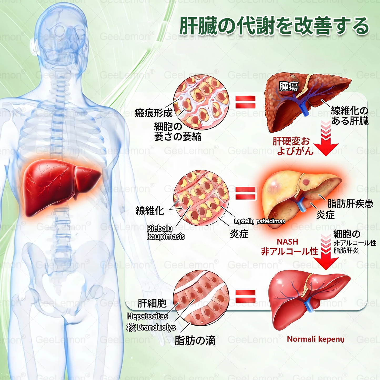 公式認定🥑日本国内で数万人ものユーザーにご満足いただいています。🔥GEELEMON ®  GLUMASETIDE 8 IN 1 マイクロガラ·ナノテクノロジーを搭載した、薄く健康的なバッチ (1日たった1回、7日間で目に見える変化)  ✅