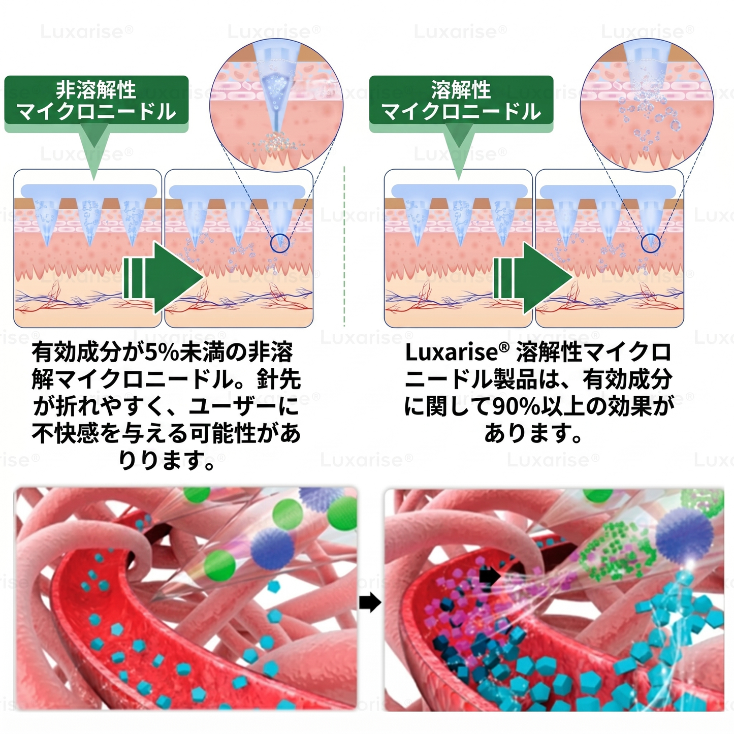 𝑳𝒖𝒙𝒂𝒓𝒊𝒔𝒆® 🌼 モリンガ×ベルベリン 高度ナノマイクロニードルパッチ(毎日使用で、7日目には目に見える変化を実感 ）👩‍⚕️ 肥満、糖尿病、睡眠時無呼吸症候群、関節のトラブル。